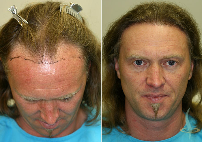 Levo: pre 1. operacije / desno: nakon druge operacije