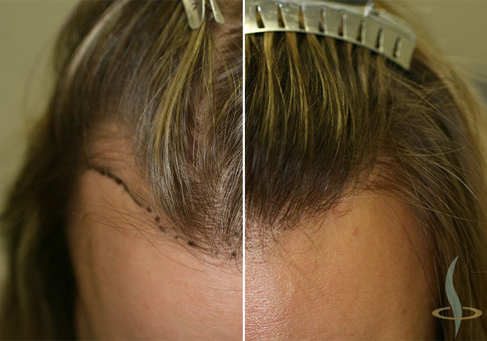 Пре и после 2. операције