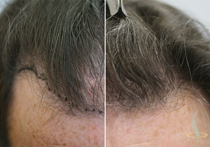 Пре и после 2. операције