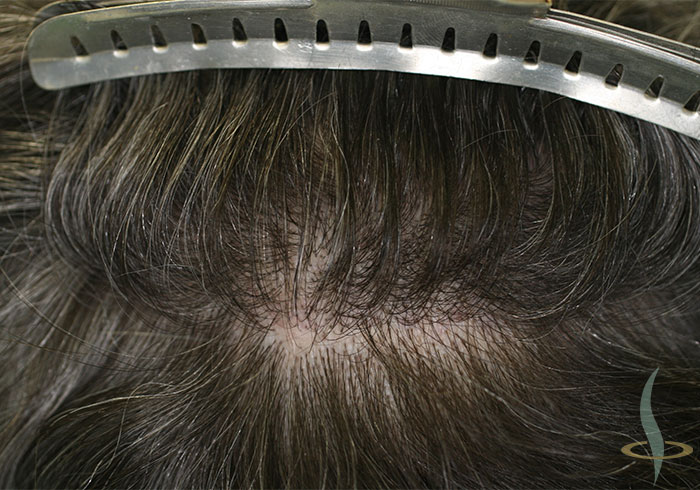 Место узимања