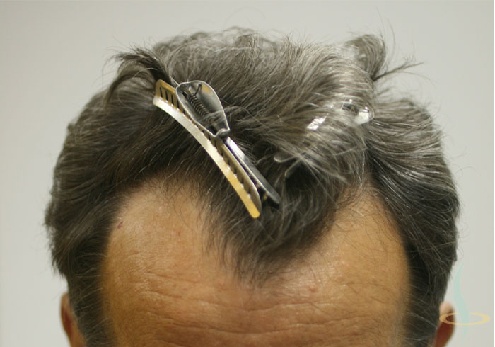 Пре операције